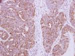 DcR3 Polyclonal Antibody