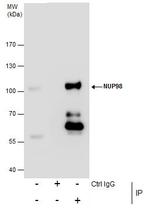 NUP98 Antibody in Immunoprecipitation (IP)