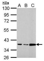 Annexin A3 Polyclonal Antibody