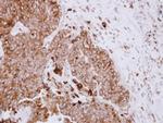ASAH1 Antibody in Immunohistochemistry (Paraffin) (IHC (P))
