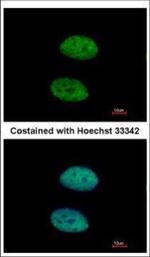 DDX3 Polyclonal Antibody