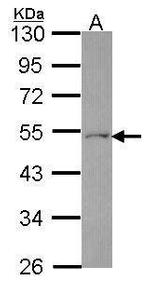 FDXR Polyclonal Antibody