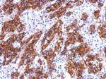 Galectin 4 Polyclonal Antibody