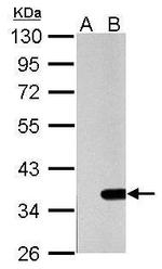 Galectin 4 Antibody in Western Blot (WB)