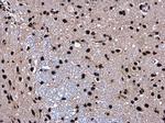 SMARCC2 Antibody in Immunohistochemistry (Paraffin) (IHC (P))