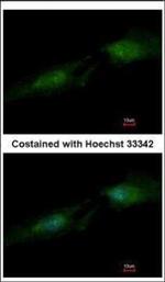 SMS Polyclonal Antibody