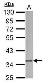 p41-ARCb Polyclonal Antibody