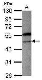 VPS4A Polyclonal Antibody