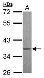 MBD3 Polyclonal Antibody