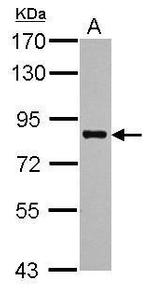 PRMT7 Polyclonal Antibody