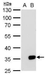 Galectin 8 Antibody in Western Blot (WB)