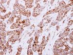 CESK1 Polyclonal Antibody