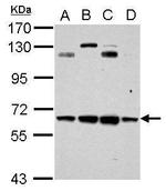 CESK1 Antibody in Western Blot (WB)