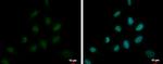 DEPDC1 Polyclonal Antibody