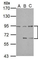 DEPDC1 Antibody in Western Blot (WB)