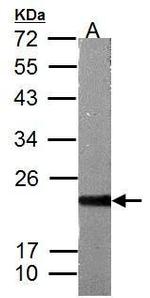 ASF1B Polyclonal Antibody