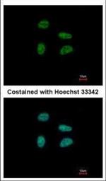GAS41 Polyclonal Antibody
