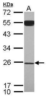GAS41 Antibody in Western Blot (WB)