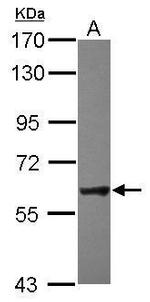 NXF2 Polyclonal Antibody