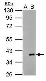 ARPC1A Antibody in Western Blot (WB)