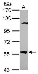OASL Polyclonal Antibody