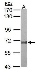 Plasma Kallikrein Polyclonal Antibody