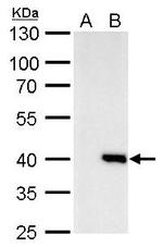 Macro H2A.2 Polyclonal Antibody