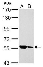 ILVBL Polyclonal Antibody