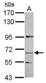 KLHL13 Polyclonal Antibody