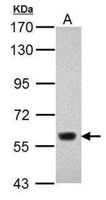 JMJD2D Polyclonal Antibody