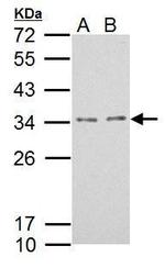 TPRG1L Polyclonal Antibody