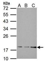TRAPPC3 Polyclonal Antibody
