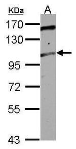 TRAK2 Antibody in Western Blot (WB)