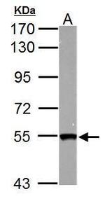 SMYD1 Polyclonal Antibody