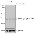 Phospho-ROCK2 (Ser1366) Antibody in Western Blot (WB)