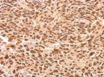 RED Antibody in Immunohistochemistry (Paraffin) (IHC (P))