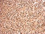 RED Antibody in Immunohistochemistry (Paraffin) (IHC (P))
