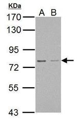 RED Antibody in Western Blot (WB)