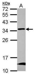 GBAS Polyclonal Antibody