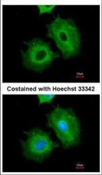 ALDH1A1 Polyclonal Antibody