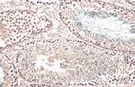 TET1 Antibody in Immunohistochemistry (Paraffin) (IHC (P))