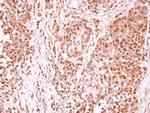 TET1 Antibody in Immunohistochemistry (Paraffin) (IHC (P))