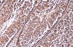 Paxillin Antibody in Immunohistochemistry (Paraffin) (IHC (P))