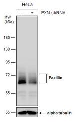Paxillin Antibody in Western Blot (WB)