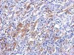 Galectin 3 Polyclonal Antibody