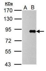 Influenza A PB1 Antibody in Western Blot (WB)