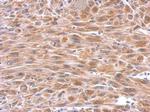 GPX8 Polyclonal Antibody