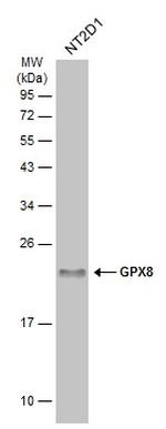 GPX8 Antibody in Western Blot (WB)