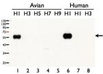 Influenza A H1N1 HA Antibody in Western Blot (WB)