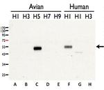 Avian Influenza H5N3 HA Polyclonal Antibody